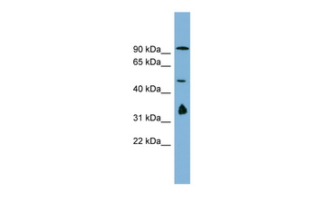 MAK10 Rabbit Polyclonal Antibody