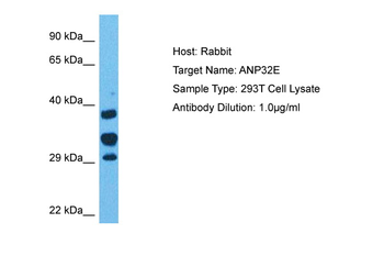 ANP32E Rabbit Polyclonal Antibody