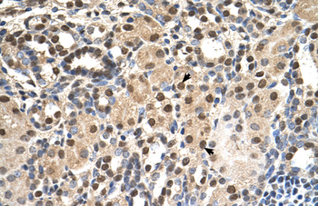 ANP32E Rabbit Polyclonal Antibody