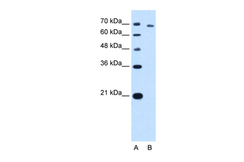 TARS Rabbit Polyclonal Antibody