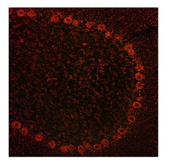 ADAM15 Rabbit Polyclonal Antibody