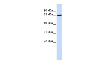 ADAM9 Rabbit Polyclonal Antibody