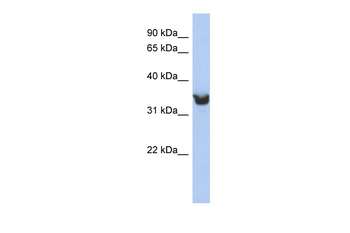 DLK1 Rabbit Polyclonal Antibody