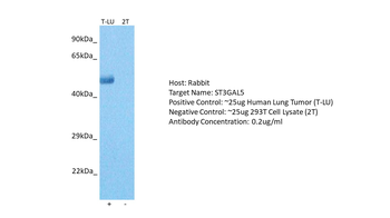 ST3GAL5 Rabbit Polyclonal Antibody