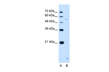 ST3GAL5 Rabbit Polyclonal Antibody