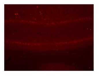SGCE Rabbit Polyclonal Antibody