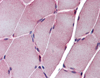 SGCE Rabbit Polyclonal Antibody