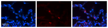 FCGRT Rabbit Polyclonal Antibody