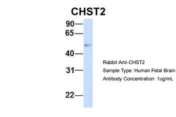 CHST2 Rabbit Polyclonal Antibody