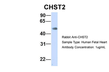 CHST2 Rabbit Polyclonal Antibody