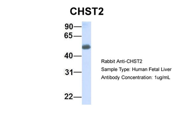 CHST2 Rabbit Polyclonal Antibody