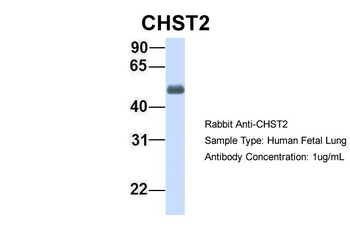 CHST2 Rabbit Polyclonal Antibody