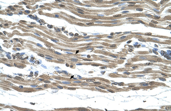 COX15 Rabbit Polyclonal Antibody