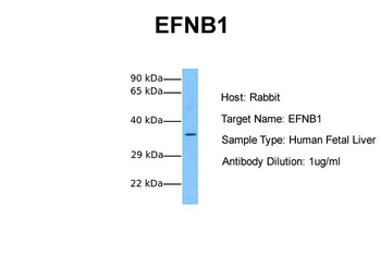 EFNB1 Rabbit Polyclonal Antibody