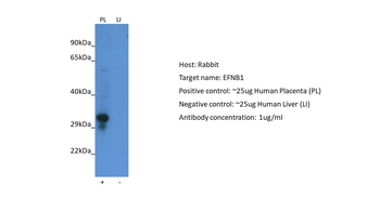 EFNB1 Rabbit Polyclonal Antibody