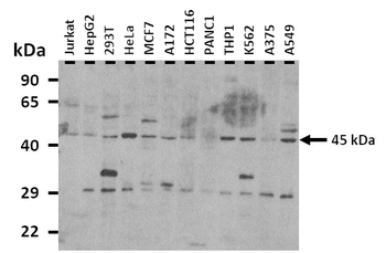 IL11RA Rabbit Polyclonal Antibody