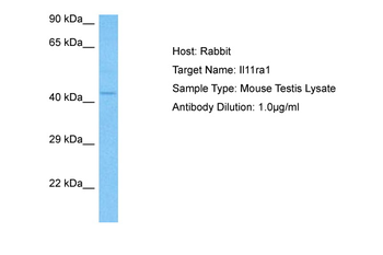 IL11RA Rabbit Polyclonal Antibody