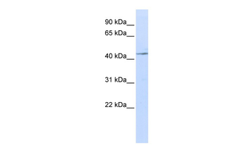 IL11RA Rabbit Polyclonal Antibody