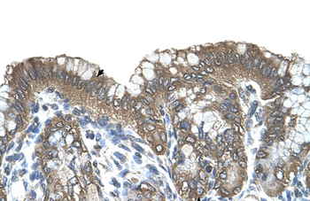 RARRES3 Rabbit Polyclonal Antibody