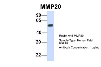 MMP20 Rabbit Polyclonal Antibody