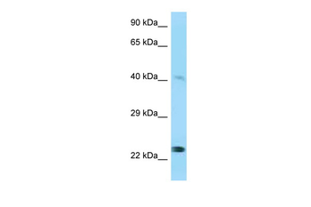 MMP20 Rabbit Polyclonal Antibody