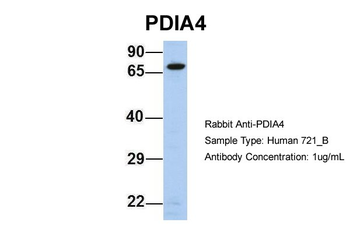 PDIA4 Rabbit Polyclonal Antibody