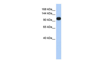 ATP2A3 Rabbit Polyclonal Antibody