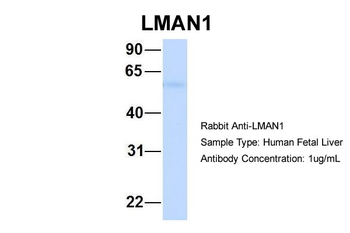 LMAN1 Rabbit Polyclonal Antibody