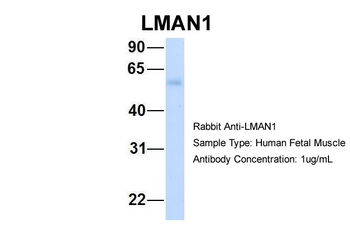 LMAN1 Rabbit Polyclonal Antibody