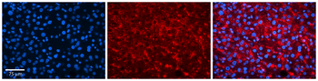 TSPAN31 Rabbit Polyclonal Antibody