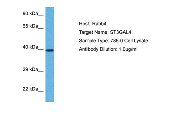 ST3GAL4 Rabbit Polyclonal Antibody
