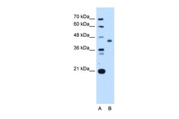 ST3GAL4 Rabbit Polyclonal Antibody