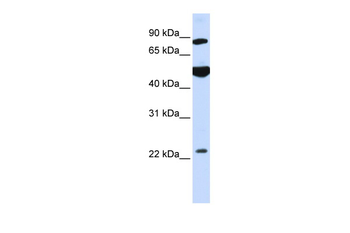 GCS1 Rabbit Polyclonal Antibody