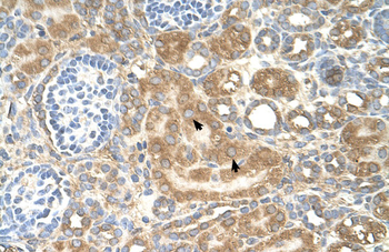 SPTLC1 Rabbit Polyclonal Antibody