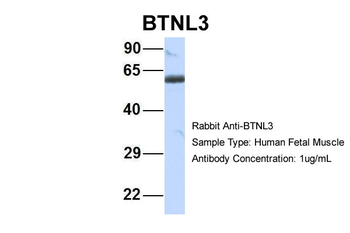 BTNL3 Rabbit Polyclonal Antibody