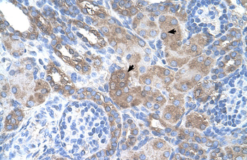 SILV Rabbit Polyclonal Antibody
