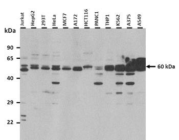 BTN2A1 Rabbit Polyclonal Antibody