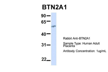 BTN2A1 Rabbit Polyclonal Antibody