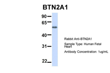 BTN2A1 Rabbit Polyclonal Antibody