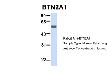 BTN2A1 Rabbit Polyclonal Antibody