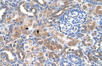 GALNT6 Rabbit Polyclonal Antibody