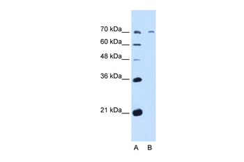 GALNT6 Rabbit Polyclonal Antibody