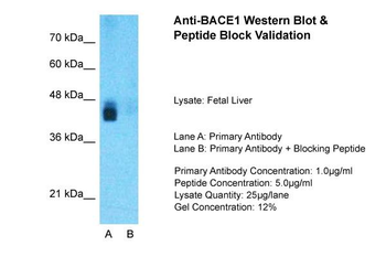 BACE1 Rabbit Polyclonal Antibody