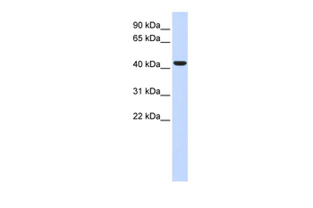 BACE1 Rabbit Polyclonal Antibody