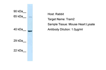 Tram2 Rabbit Polyclonal Antibody
