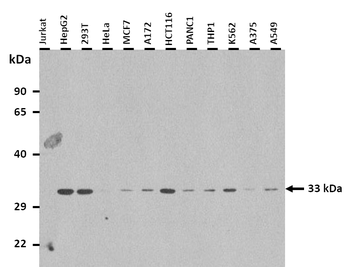 TSPAN15 Rabbit Polyclonal Antibody