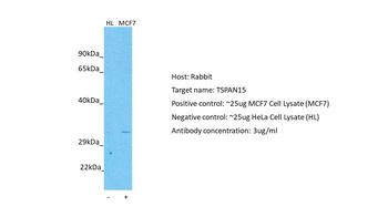 TSPAN15 Rabbit Polyclonal Antibody
