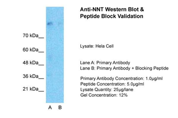 NNT Rabbit Polyclonal Antibody
