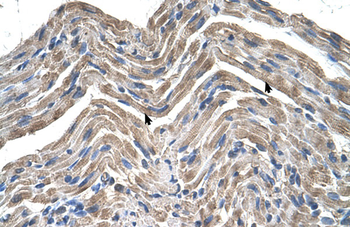 NPTN Rabbit Polyclonal Antibody