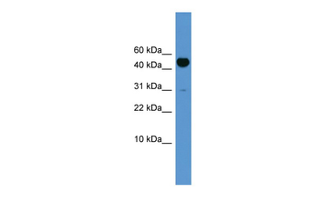 Bmp10 Rabbit Polyclonal Antibody